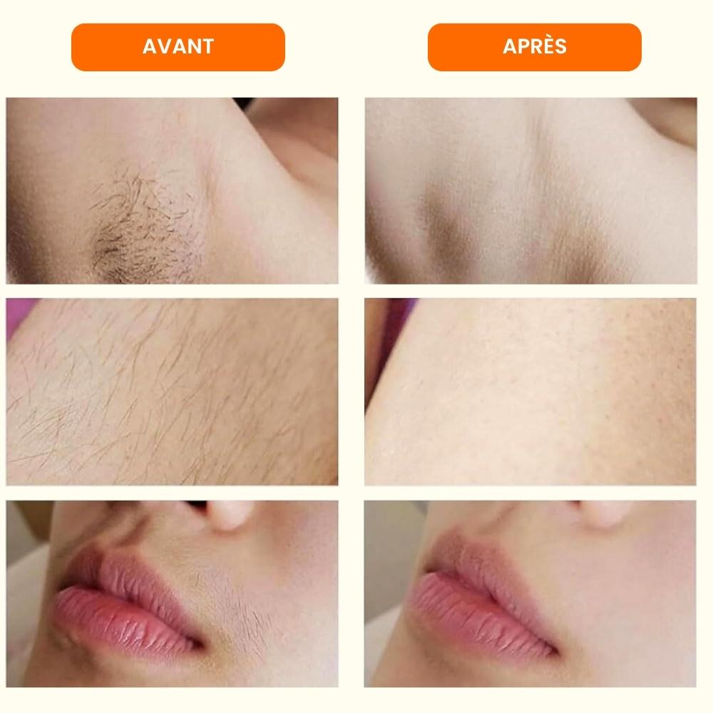 VelvetSkin™ – Rasoir électrique femme double tête IPX7
